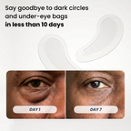 Microneedle Patches | New Generation